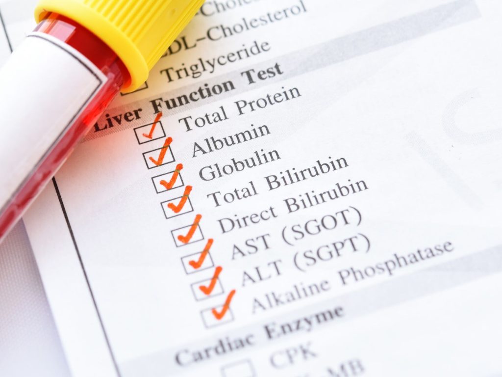 liver function tests